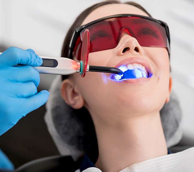 Cookeville Professional Teeth Whitening